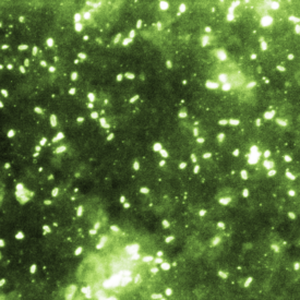Legionella: A Stealthy Bacteria Hiding in Plain Sight